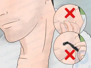 How to Stop Itching After Shaving
