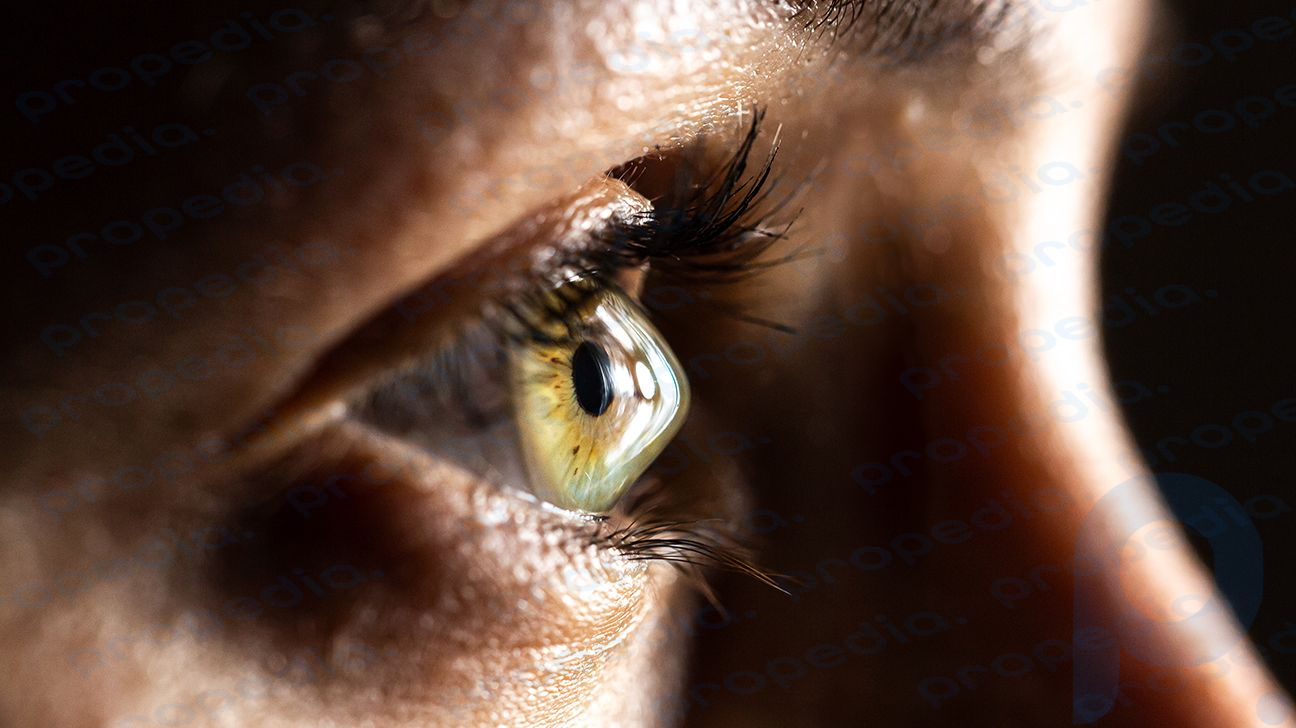 Um close do olho de uma mulher com ceratocone.
