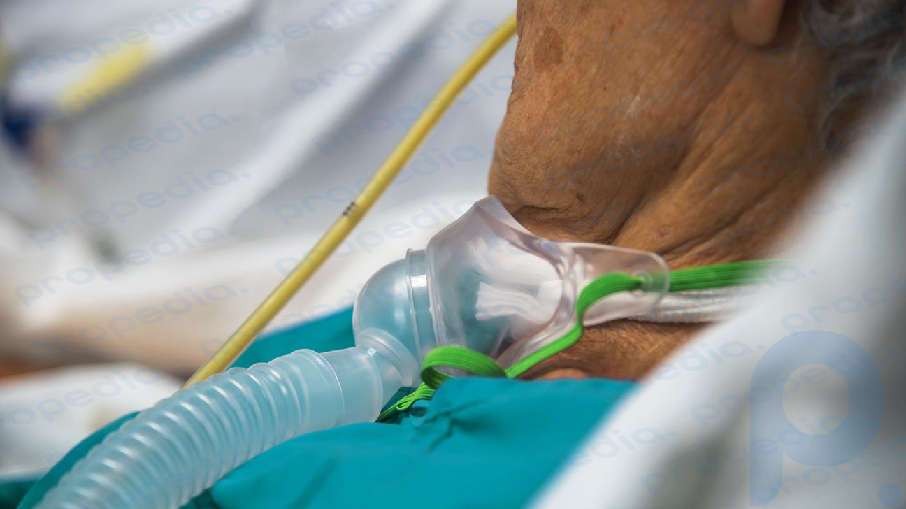 persona en una cama de hospital con un ventilador-1