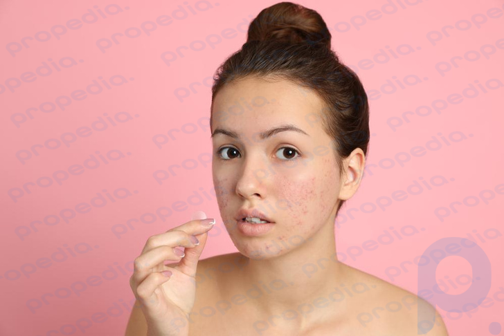 “Everything that is natural is beautiful”: is it necessary to deal with skin imperfections?