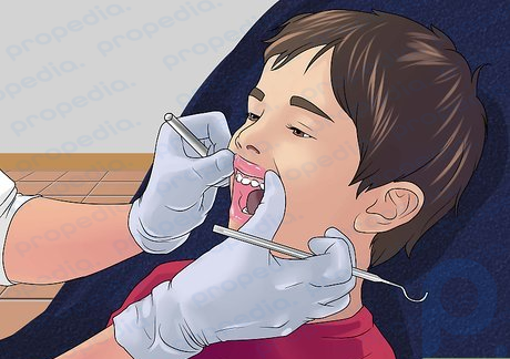 Schritt 1 Lassen Sie Ihre Zähne von einem Zahnarzt ziehen.