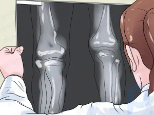 Bir Bacağın Kısa Olup Olmadığı Nasıl Anlaşılır