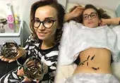 Dünne Taille und Blutegel am Bauch: Die abgenommene Tschechowa überraschte ihre Follower mit einem neuen Foto