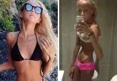 Une Australienne s'est rendue à l'anorexie pour ressembler à Miranda Kerr