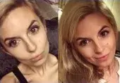 Uma menina que sofre de anorexia luta contra a doença com a ajuda do Instagram (uma organização extremista proibida na Rússia)