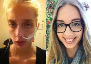 “I would rather die than eat”: a 26-year-old Australian woman spoke about her struggle with anorexia