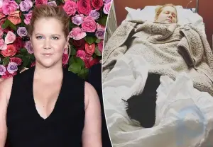 Pregnant Amy Schumer was hospitalized due to severe toxicosis, like Kate Middleton