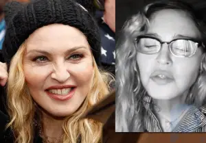 Die 59-jährige Madonna enttäuschte ihre Fans mit einer bewegungslosen Gesichtsmaske
