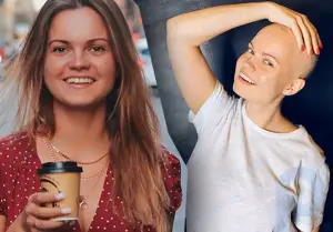 26-летняя красавица-дочь Владимира Левкина, борющаяся с раком, побрилась налысо после лучевой терапии