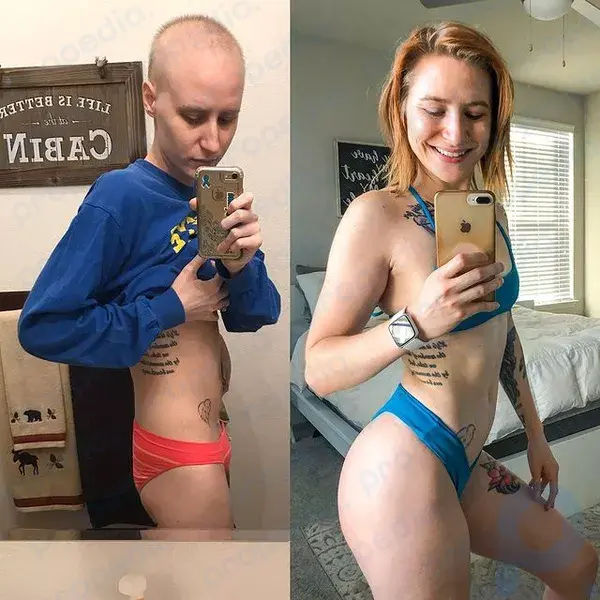 Yumurtalık kanseri sonrası vücudunu nasıl toparladığını gösteren fitness modeli, 5 yıl boyunca kanserle mücadele ettikten sonra hayatını kaybetti.