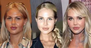 Maria Pogrebnyak antes y después de la cirugía plástica: 4 operaciones que le permitieron tener el “rostro de esposa de un futbolista”