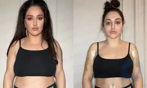 What the body looks like after liposuction: honest footage of an Instagram star (an extremist organization banned in Russia)