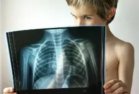 Lungenentzündung bei Kindern: Symptome, Behandlung und Vorbeugung einer Lungenentzündung bei einem Kind