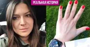„Wenn ich früher Alarm geschlagen hätte, hätte ich meine Nägel nicht entfernen müssen“: Wie ein Moskauer nach einer Maniküre von schlechter Qualität mit schweren Krankheiten konfrontiert wurde