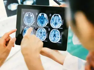 Réparation d'un anévrisme cérébral : procédure, préparation et risques