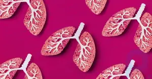 Types of Non-Small Cell Lung Cancer: Causes, Treatment, and Outlook