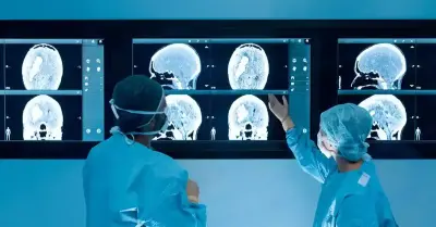 Une IRM peut-elle détecter un anévrisme cérébral ?