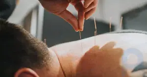 Akupunktur Gerçekten Astım Tedavisinde Çalışıyor mu?