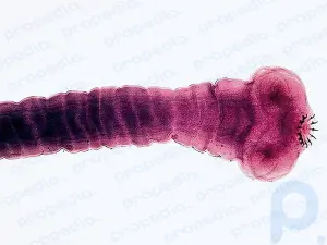 Ungebetene Gäste: Die 7 schlimmsten parasitären Würmer