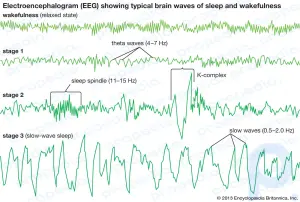Resumen del sueño: Conozca las etapas REM y NREM del sueño