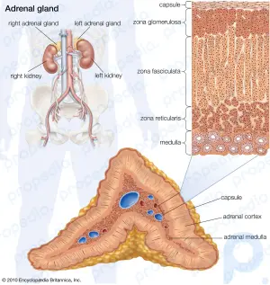 Addison disease: pathology