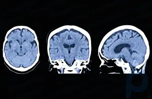 Кора головного мозга: анатомия