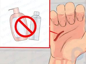 How to Remove a Liquid Bandage