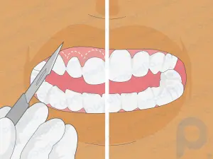 Cómo enderezar los dientes torcidos sin frenillos