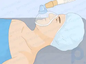 Comment traiter la constipation après une chirurgie de hernie