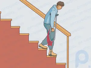 How to Use Crutches