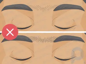 Quelles sont les causes d’un Unibrow ? Réponses à vos 6 principales questions sur Unibrow