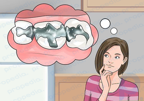 Step 4 Know the basics of cavities and fillings.