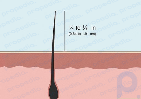 It's best for hair to be 1⁄4 to 3⁄4 in (0.64 to 1.91 cm) long.