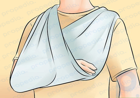 Step 1 Wear a sling while in bed.