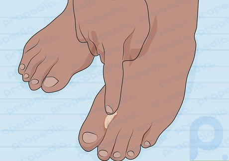 Step 4 Apply an antibiotic ointment or petroleum jelly so the cut doesn’t get infected.