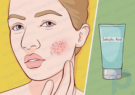 Paso 2 ¿Quieres abordar algún problema o inquietud de la piel en tu rutina de cuidado de la piel?