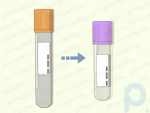 Comment dépanner une ponction veineuse difficile