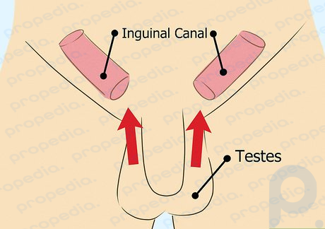 Step 3 Lift the testes into the inguinal canals to obscure them completely.