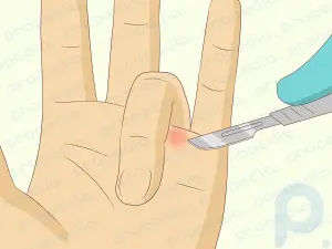 Como consertar a dor nos nós dos dedos
