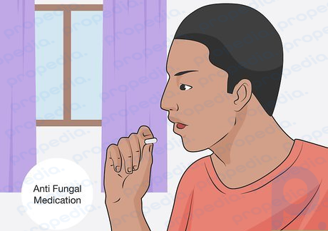 Step 5 Take oral antifungal medication if the rash doesn’t respond to cream.