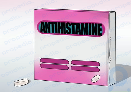 Step 2 Use antihistamines.
