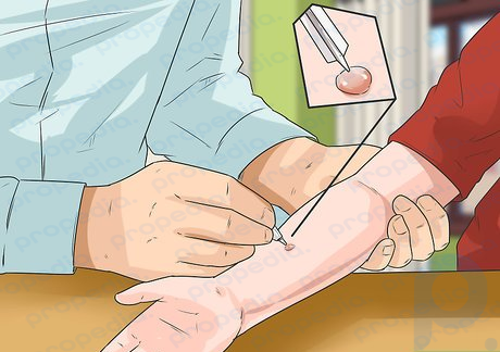 Step 5 Have an allergist test your child.