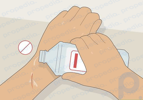 Step 4 Avoid using harsh antiseptics on minor wounds.